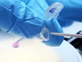 流产出来的胚胎可以做亲子鉴定吗