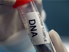 DNA亲子鉴定准确吗